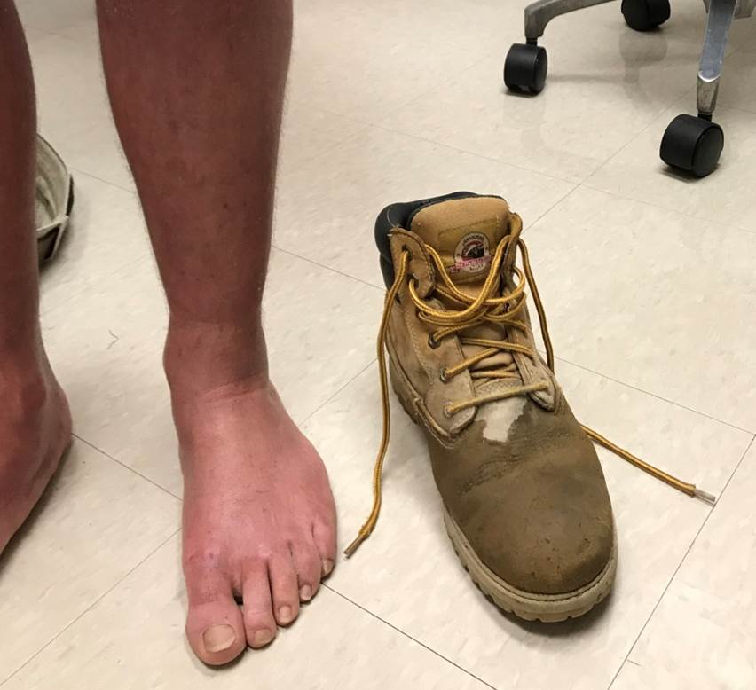 What Is This Construction Worker’s Spreading, Itchy Rash? Consultant360